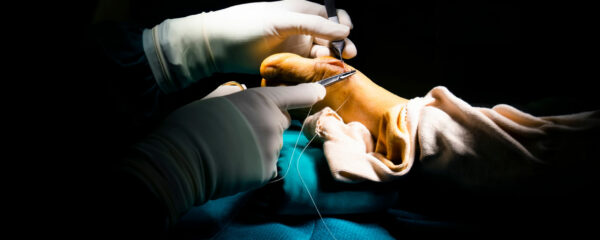 chirurgien du pied